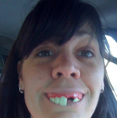 funny+teeth.png
