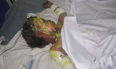 An-injured-Afghan-child-a-001%255B1%255D.jpg