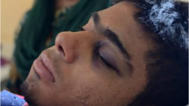 160713174812_kashmir_injured_in__hospitals_bilal_bahadur_640x360_bilalbahadur_nocredit.jpg