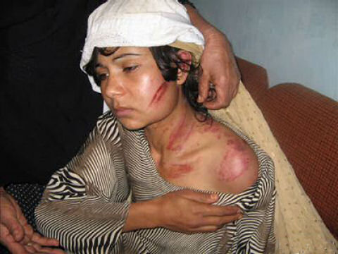 afghanistan-bloodied-woman.jpg