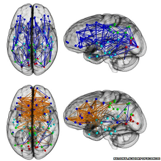 131203132057_brain_scan_549x549_nationalacademyofsciences_nocredit.jpg