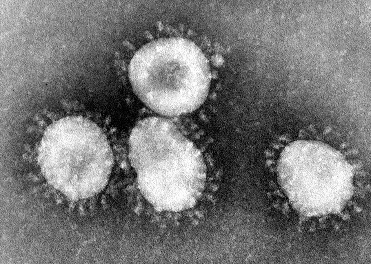 1280px-Coronaviruses_004_lores.jpg